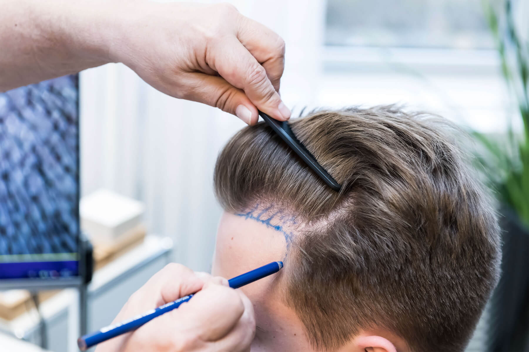 Investieren Sie in Ihre Zukunft - HairDoc Haartransplantation Düsseldorf